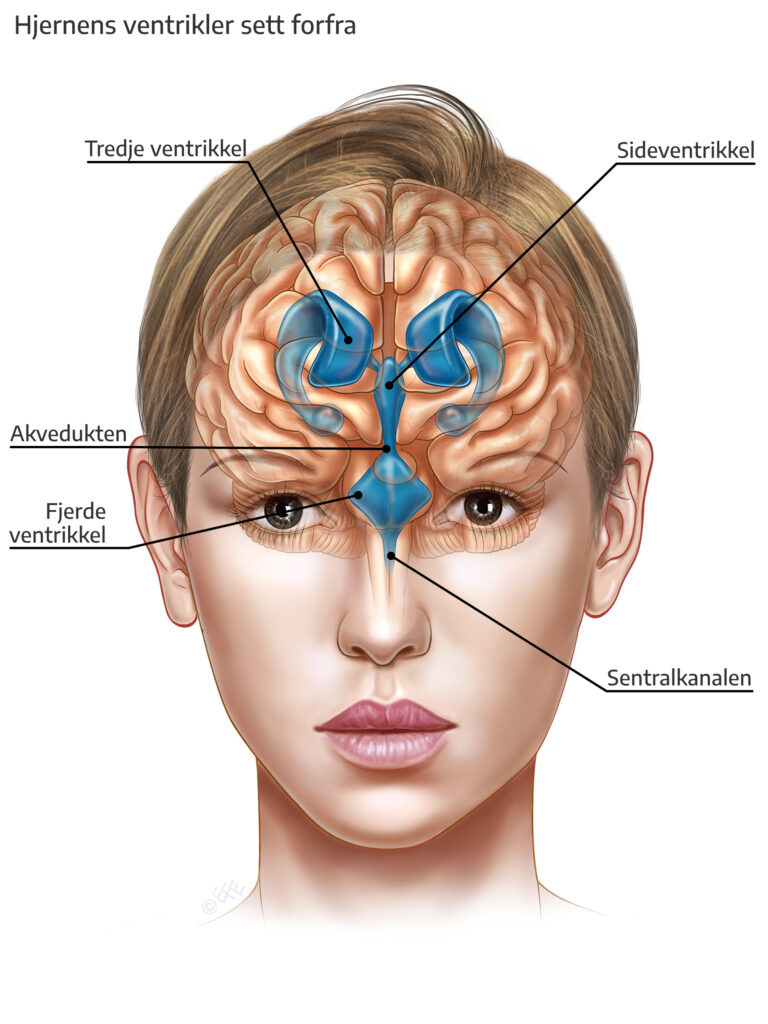 Hjernens ventrikler forfra
